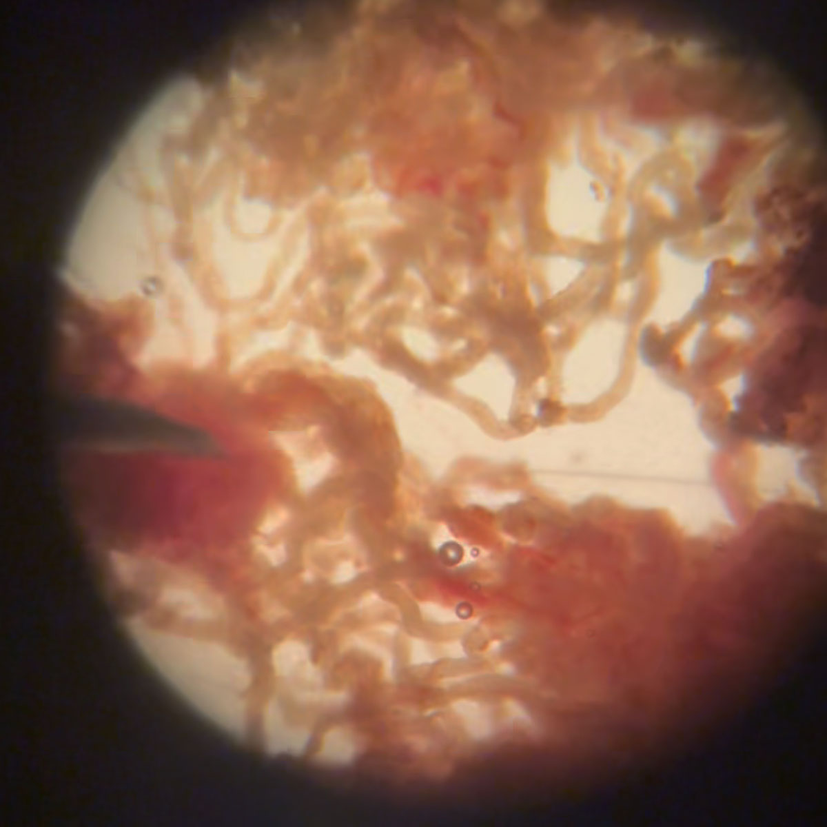 Microtese aspetto tabulli al microscopio